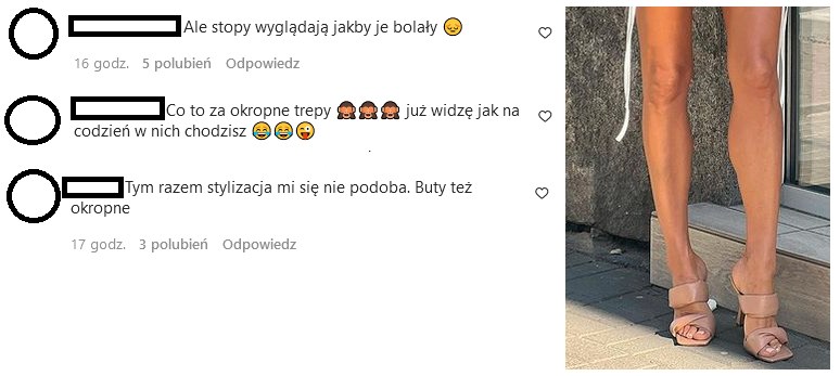 Komentarze dotyczące stóp Rozenek na IG@m_rozenek/ /Instagram