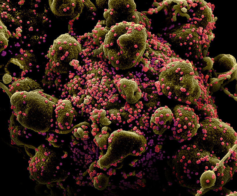 Komórka zainfekowana SARS-COV-2, zdj. ilustracyjne /NIAID/Reuters /Agencja FORUM