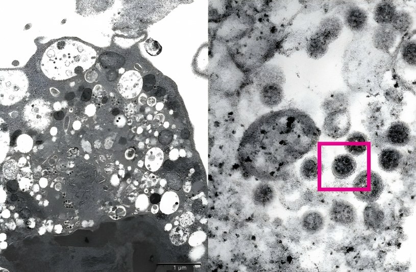Komórka zainfekowana wariantem Omikron /DPT OF MICROBIOLOGY HKU / LPN / IMAGE POINT FR /East News