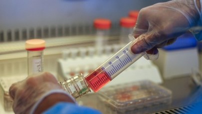 Komórkami macierzystymi w autyzm? Duże nadzieje, miesiące oczekiwań