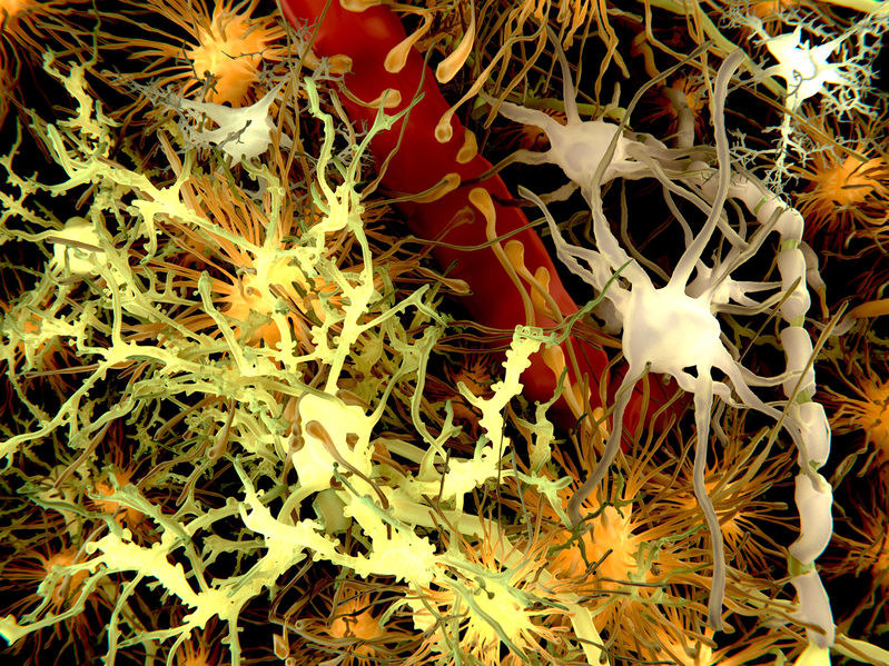 Komórki mózgu - astrocyty zaznaczono tu na pomarańczowy kolor /123RF/PICSEL