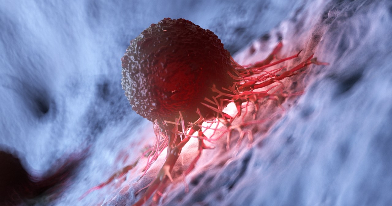 Komórki nowotworowe mają swój własny mikrobiom /123RF/PICSEL
