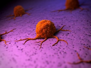 Komórki nowotworowe nie dzielą się podczas przerzutowania