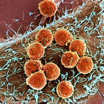 Komórki nowotworowe podszywają się pod białe krwinki