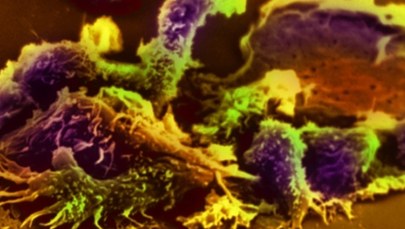 Komórki nowotworowe są zaraźliwe