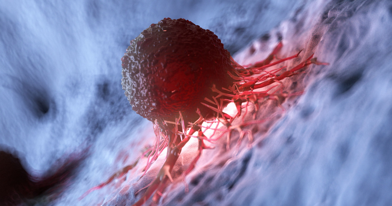 Komórki nowotworowe wpływają także na zdrowe tkanki /123RF/PICSEL