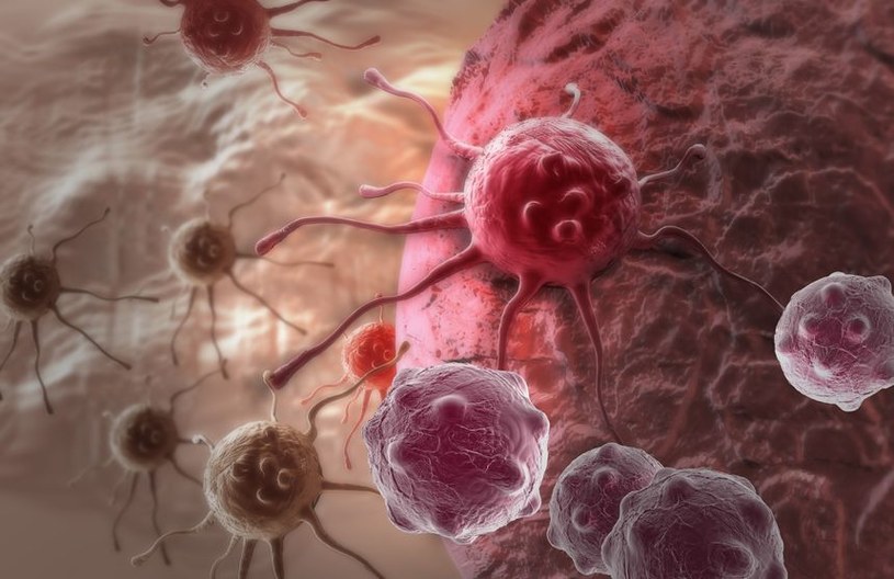 Komórki nowotworowe /&copy;123RF/PICSEL