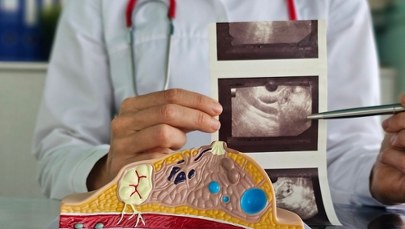 Komórki tłuszczowe mogą zagłodzić raka