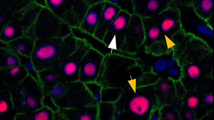 Komórki wątroby z dwoma zestawami chromosomów oznaczono białą strzałką, te z większą ilością DNA, żółtymi strzałkami /Materiały prasowe