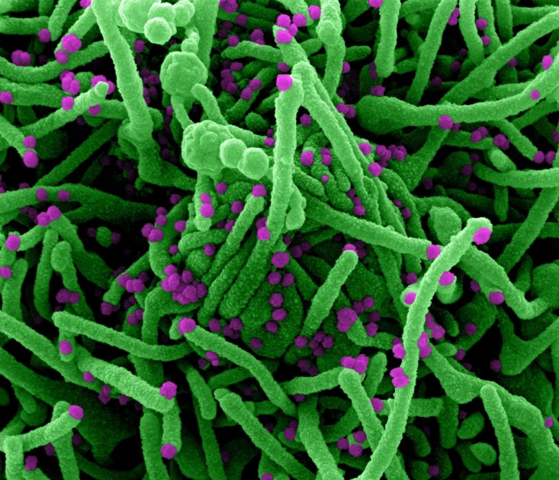 Komórki zainfekowane koronawirusem SARS-CoV-2, koloryzowane /IMAGE POINT FR/NIH/NIAID/BSIP/Universal Images Group via Getty Images /Getty Images