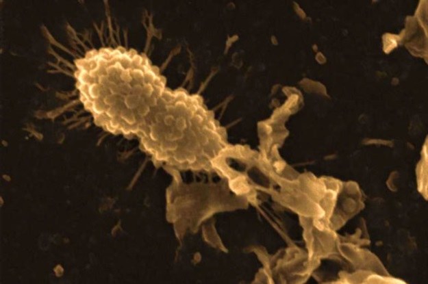 Kompleks HAMLET atakuje lekooporną bakterię /materiały prasowe