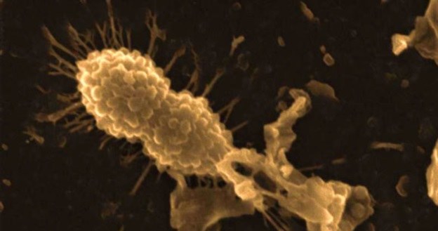 Kompleks HAMLET atakuje lekooporną bakterię /materiały prasowe