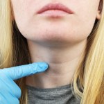 Kompleksowa diagnostyka tarczycy. Nie wystarczy wynik TSH