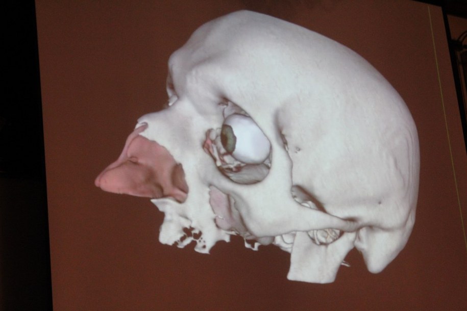 Komputerowy system pozwala na tworzenie wizualizacji wnętrza ludzkiego ciała /Piotr Bułakowski /RMF FM