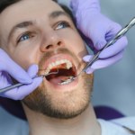 Koniec bólu w fotelu dentystycznym? Sprawdź nowe terapie próchnicy