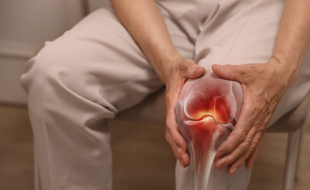 Koniec z bólem kolan? Nowa terapia choroby zwyrodnieniowej stawów