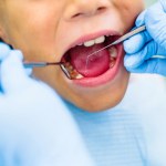 Koniec z borowaniem? Opracowali żel, który naprawia zęby