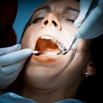Koniec z czarnymi plombami w zębach u dzieci i kobiet w ciąży