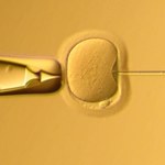 Koniec z refundacją in vitro: Kliniki wstrzymują przyjęcia nowych par