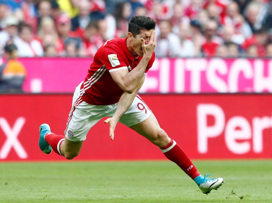 Kontuzjowany w twarz Robert Lewandowski /AA/ABACA /PAP/EPA