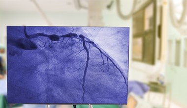 Koronarografia oceni stan tętnic