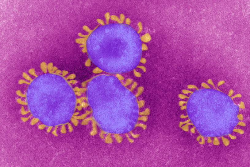 Koronawirus pod mikroskopem, koloryzowane /BSIP /Getty Images