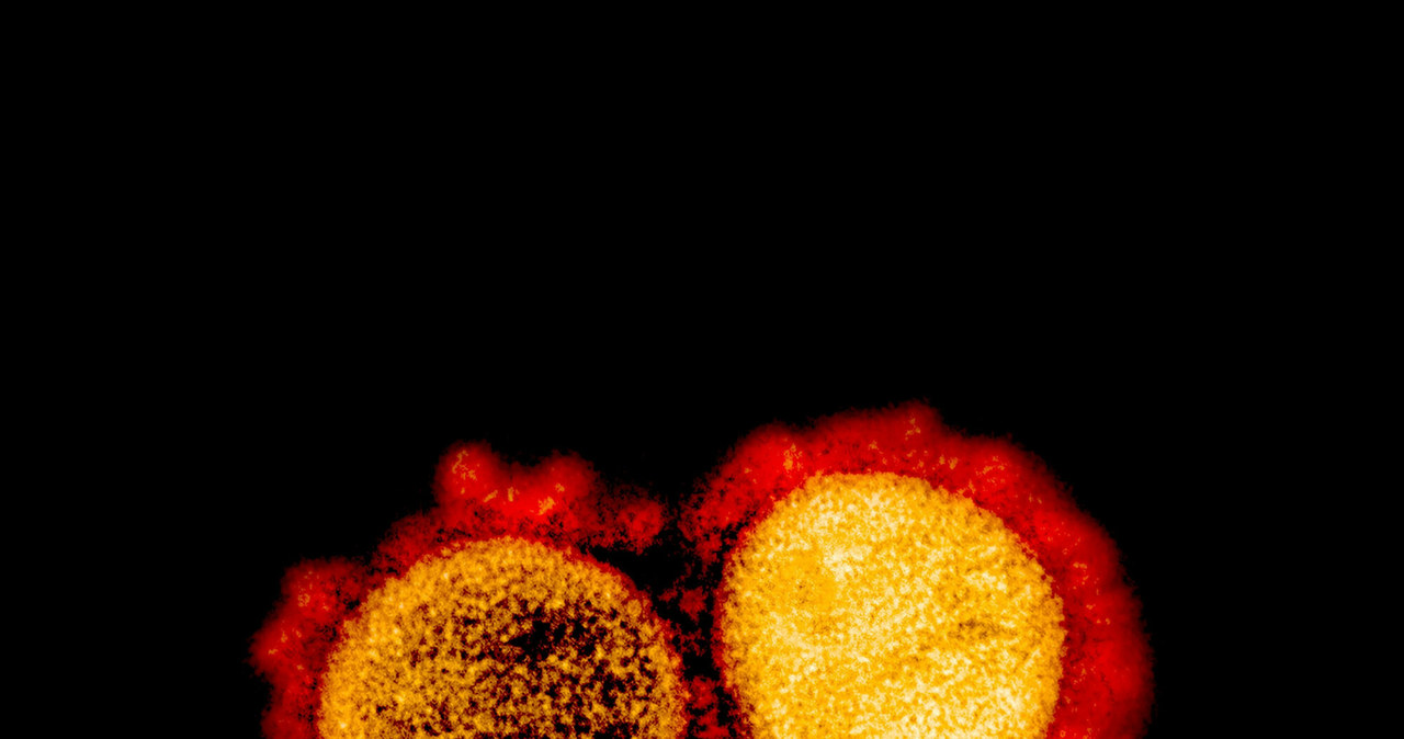 Koronawirus pod mikroskopem /HANDOUT/AFP /East News