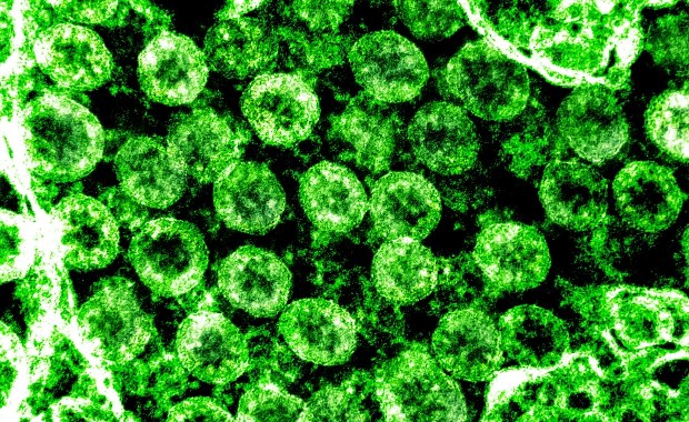 Koronawirus. Przypadek pomógł zaobserwować najwcześniejsze skutki infekcji