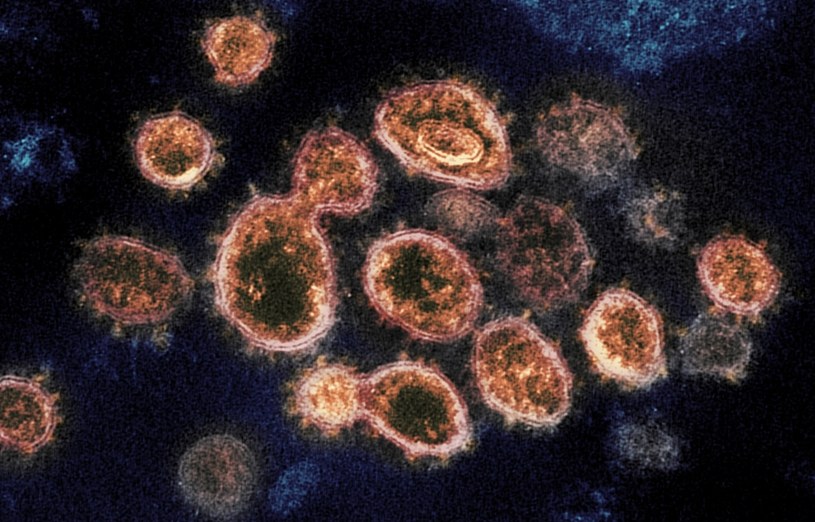 Koronawirus SARS-CoV-2 widziany pod mikroskopem /NIAID-RML/Associated Press/ /East News