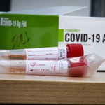 Koronawirus. Szybkie testy antygenowe będą wykorzystywane w Polsce do stwierdzania zakażenia
