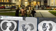 Koronawirus w Belgii. Lekarz: Skany płuc młodych ludzi są przerażające