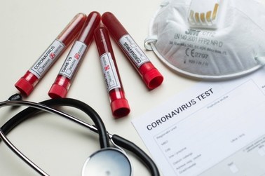 Koronawirus w Hiszpanii: 44 ofiary wśród lekarzy