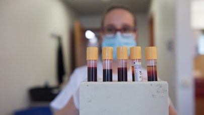 Koronawirus w Polsce. 318 nowych przypadków i 15 zgonów