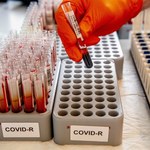 Koronawirus w Polsce: Po fatalnym weekendzie wyraźny spadek nowych zachorowań [NOWE DANE]
