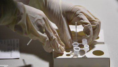 Koronawirus w sanatorium w Ustroniu. Sześć osób zakażonych 