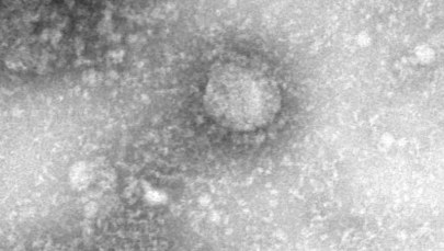 Koronawirus z Chin. Szczepionka możliwa już za trzy miesiące