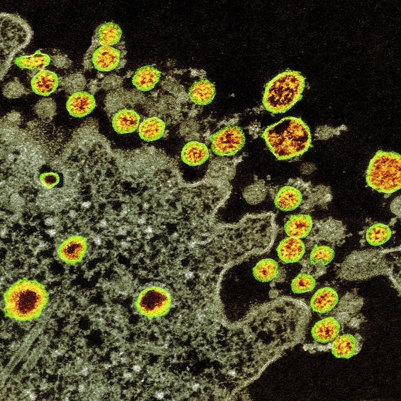 Koronawirus z Wuhanu rozprzestrzenia się na całej kuli ziemskiej. Zarażonych nim jest już 98 tys. osób w 65 krajach /CDC /East News