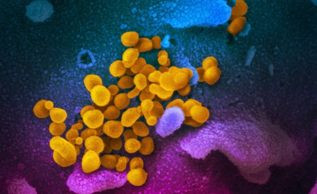 Koronawirus zakaża skuteczniej niż SARS? Nowe fakty ws. wirusa z Chin