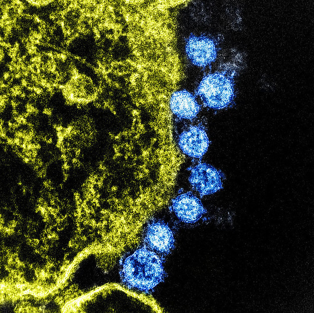 Koronawirusy MERS (kolorowane na niebiesko) zobrazowane w laboratoriach NIAID Integrated Research Facility w Fort Detrick w stanie Maryland / NIAID /Materiały prasowe