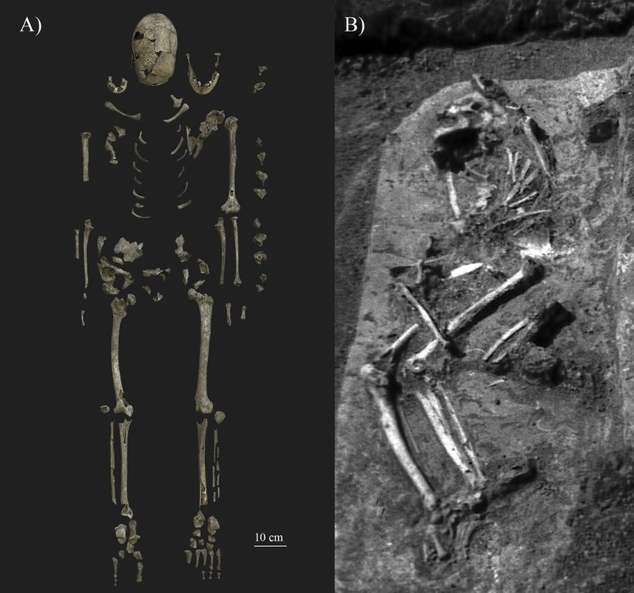 Kości znalezione w grobie /PLoS ONE 19(11): e0313963 /