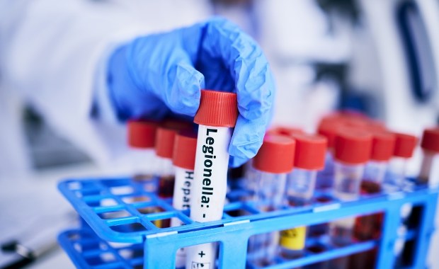 ​Kraska dla RMF FM o legionelli: Prognozy są optymistyczne