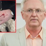 Krew na dłoni Brauna. Przepychanki podczas rozprawy dr. Martyki