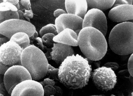 Krew pod mikroskopem fot.National Cancer Institute /Kopalnia Wiedzy