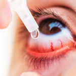 Krople do oczu zapobiegające ślepocie