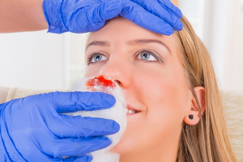 Krwotoki z nosa to ostrzeżenie /123RF/PICSEL