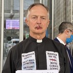 ​Ksiądz Tim Hewes zszył sobie usta. Protestuje przeciwko Rupertowi Murdochowi
