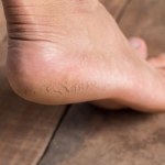 Kup w aptece i nałóż na pięty. Będą gładkie całą wiosnę