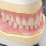 Kupił w sieci protezę zębową. Nie mógł uwierzyć w to, co zobaczył