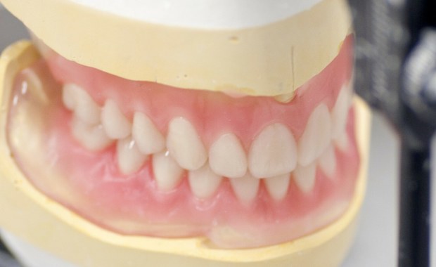 Kupił w sieci protezę zębową. Nie mógł uwierzyć w to, co zobaczył
