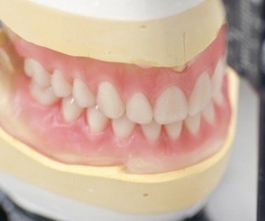 Kupił w sieci protezę zębową. Nie mógł uwierzyć w to, co zobaczył